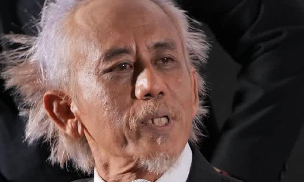 Menderita Kanker Otak Sejak 2010, Umur Epy Kusnandar Diprediksi Hanya Bertahan 4 Bulan