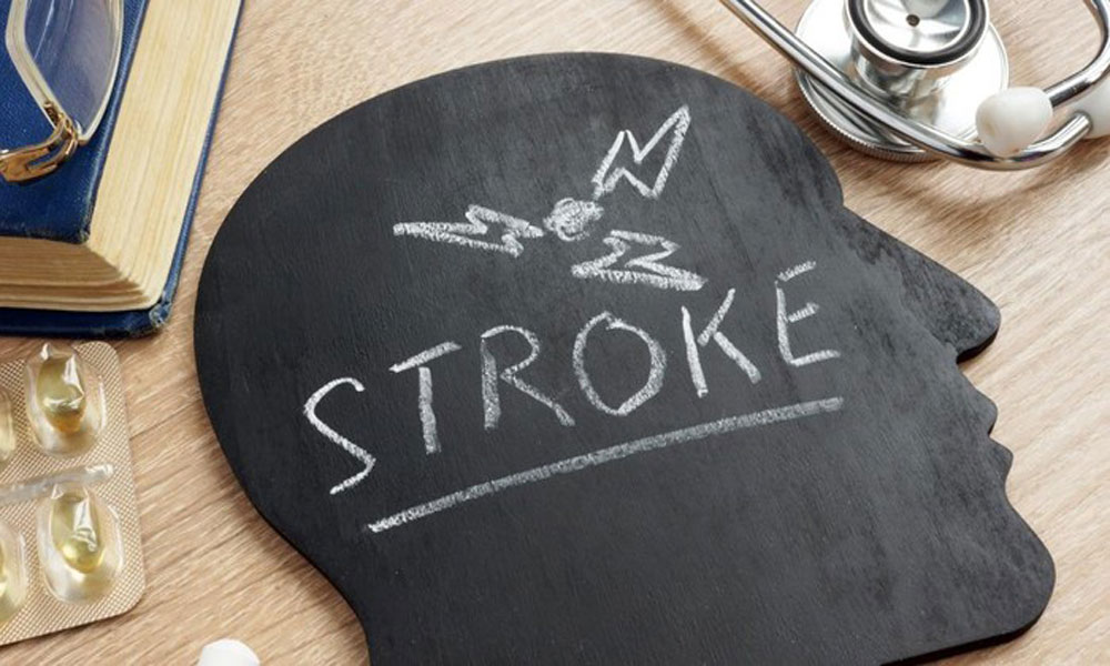 Pria Bugar Pola hidup Sehat di Inggris Terserang Stroke, ini Penyebabnya 