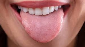 Ini 7 Ciri-ciri Lidah yang Tak Sehat, Lidah Kamu Gimana?