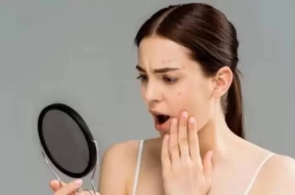 Hindari! Ini 5 Kesalahan Saat Eksfoliasi Kulit Wajah 