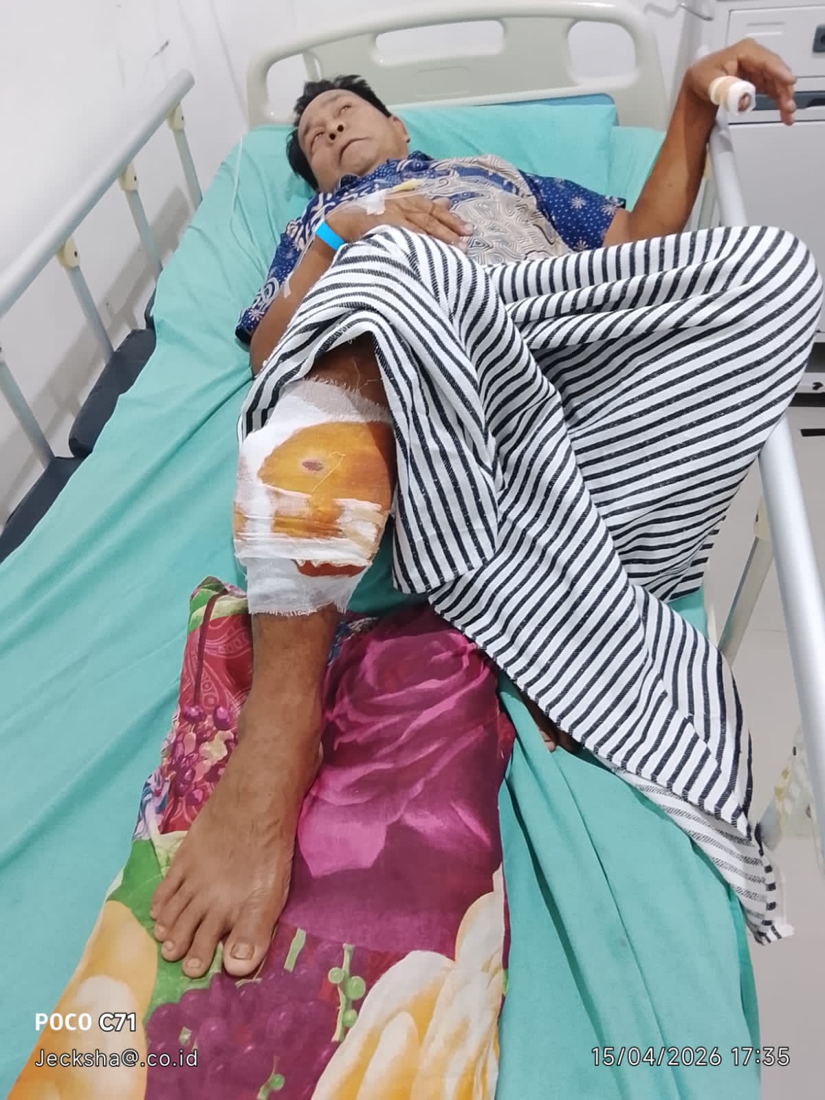 Warga OKU Diserang  Beruang,  Kaki dan Jari Tangan Robek