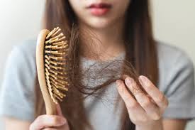 Tips Ampuh Mengatasi Rambut Rontok dengan 7 Bahan Alami, Bikin Rambut Kuat dan Nggak Gampang Rontok!