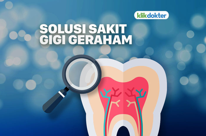 Kapan Gigi Geraham Bungsu Harus Dicabut? ini Kata Dokter