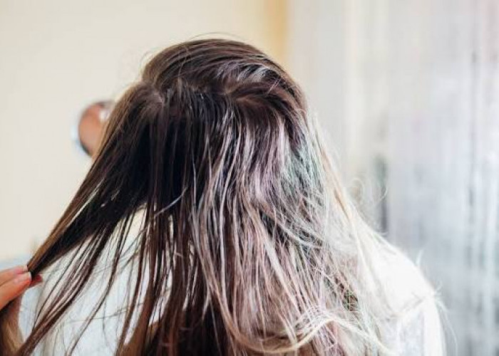 Simak! Inilah 8 Penyebab Rambut Lepek dan Cara Merawatnya