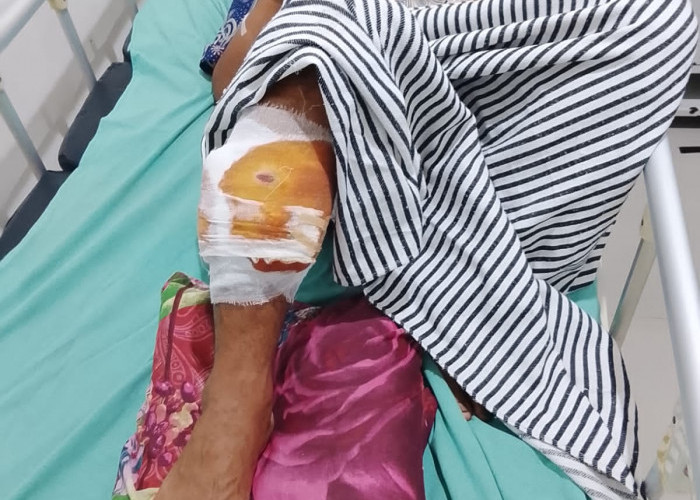 Warga OKU Diserang  Beruang,  Kaki dan Jari Tangan Robek