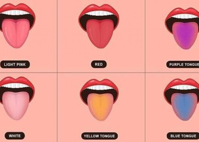 Apakah Melihat dari Warna Lidah Bisa Menunjukkan Kondisi Kesehatan?