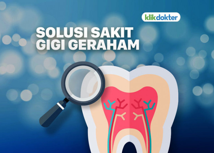 Kapan Gigi Geraham Bungsu Harus Dicabut? ini Kata Dokter