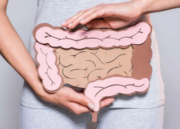 Kanker Rektum Menyerang Usia di Bawah 65 Tahun, ini Saran Dokter