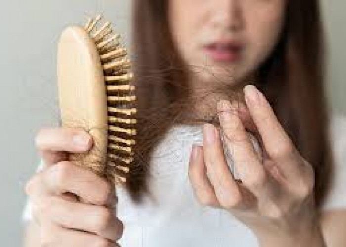 Inilah 5 Cara Efektif Mengatasi Rambut Rontok