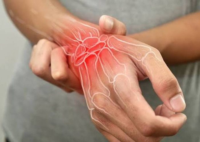 Waspadai, 6 Kebiasaan Buruk Ini Bisa Jadi Penyebab Radang Sendi