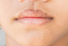 Bibir Hitam Bikin Minder? Ini 6 Solusi Efektif yang Wajib Dicoba