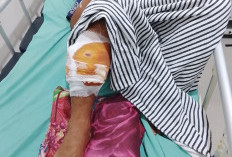 Warga OKU Diserang  Beruang,  Kaki dan Jari Tangan Robek