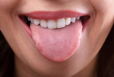 Simak! Ini 6 Penyebab Lidah Terasa Pahit dan Cara Mengatasinya