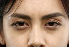 4 Tips Mengatasi Lingkar Hitam pada Mata saat Kurang Tidur di Bulan Ramadan